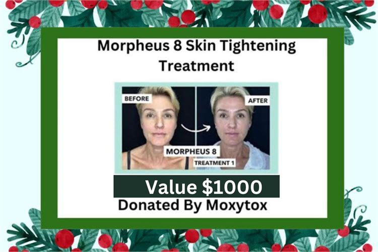 $1000 Value Two $500 Moxytox Morpheus 8 Skin tightening Treatments